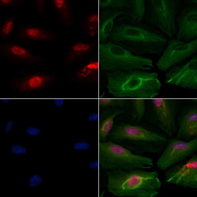 SART1 Antibody in Immunocytochemistry (ICC/IF)