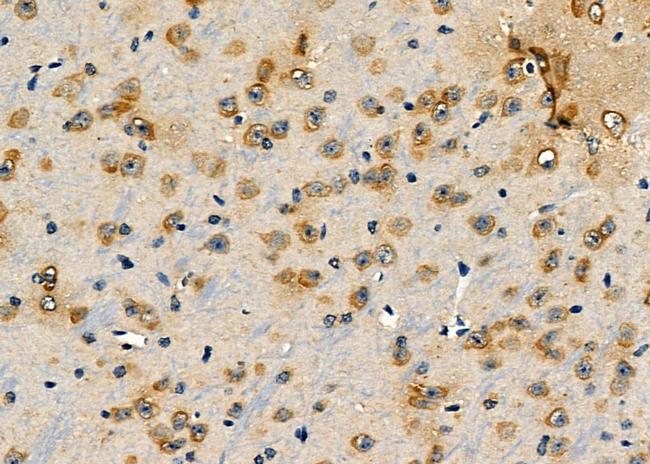 Syntenin 1 Antibody in Immunohistochemistry (Paraffin) (IHC (P))