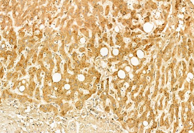 SESN2 Antibody in Immunohistochemistry (Paraffin) (IHC (P))