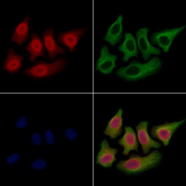 SET Antibody in Immunocytochemistry (ICC/IF)