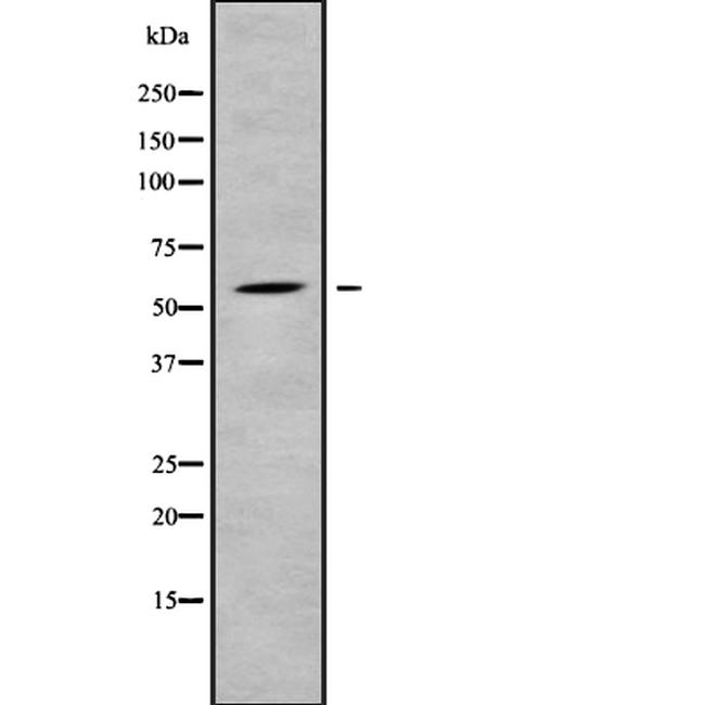 SFRS12 Antibody in Western Blot (WB)