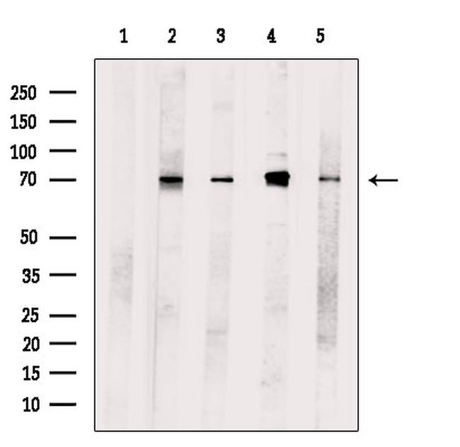 MAPKAP1 Antibody in Western Blot (WB)