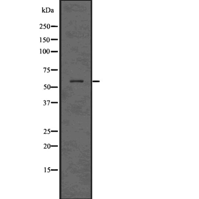 MAPKAP1 Antibody in Western Blot (WB)