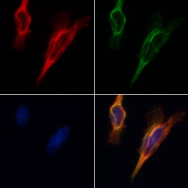 SIRT3 Antibody in Immunocytochemistry (ICC/IF)