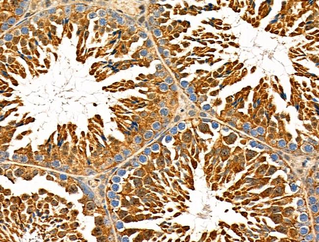 ZIP1 Antibody in Immunohistochemistry (Paraffin) (IHC (P))