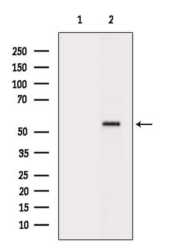 SMAD1/SMAD5/SMAD9 Antibody in Western Blot (WB)