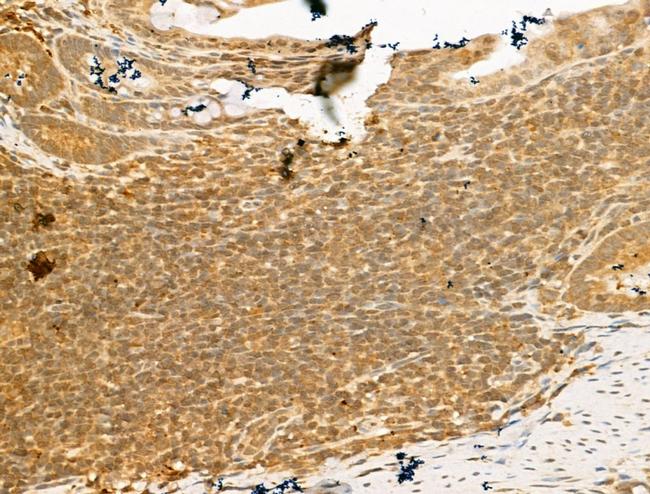 SMC2 Antibody in Immunohistochemistry (Paraffin) (IHC (P))