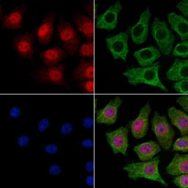 SMC5 Antibody in Immunocytochemistry (ICC/IF)