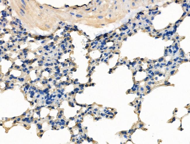 SMCHD1 Antibody in Immunohistochemistry (Paraffin) (IHC (P))