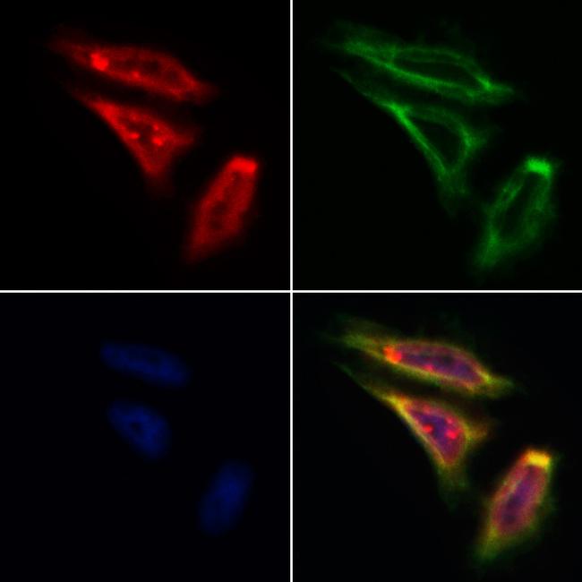 SMYD3 Antibody in Immunocytochemistry (ICC/IF)