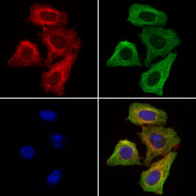 SORL1 Antibody in Immunocytochemistry (ICC/IF)