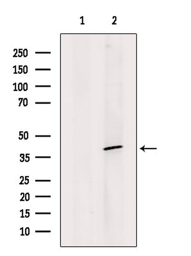 SOX18 Antibody in Western Blot (WB)