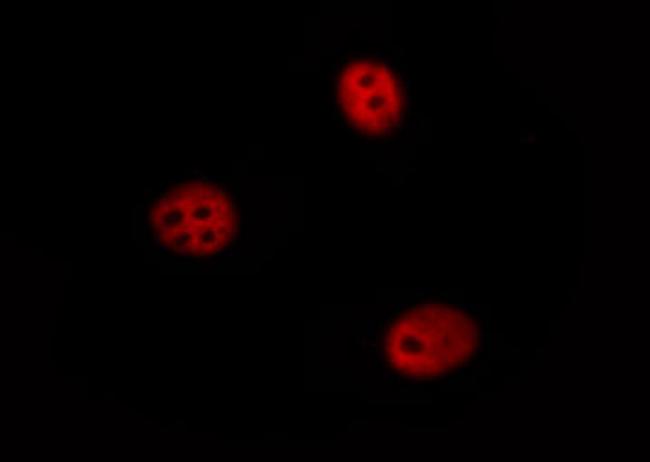 SP1 Antibody in Immunocytochemistry (ICC/IF)