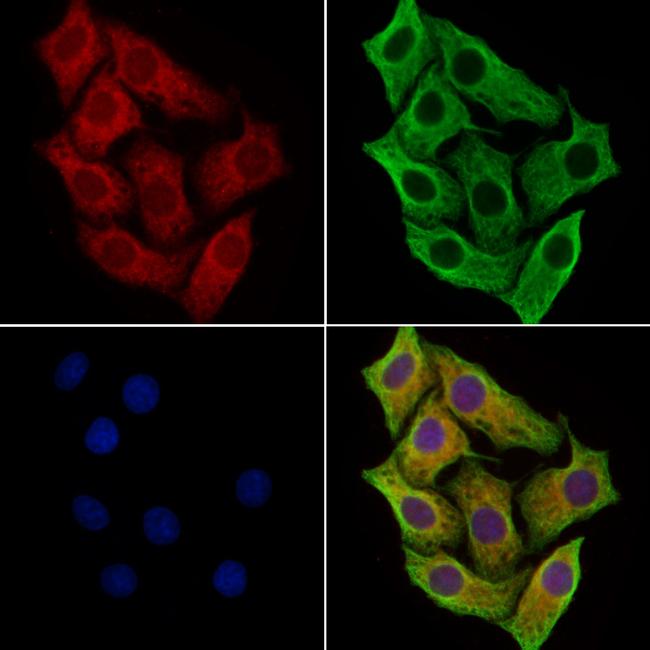 SIL Antibody in Immunocytochemistry (ICC/IF)