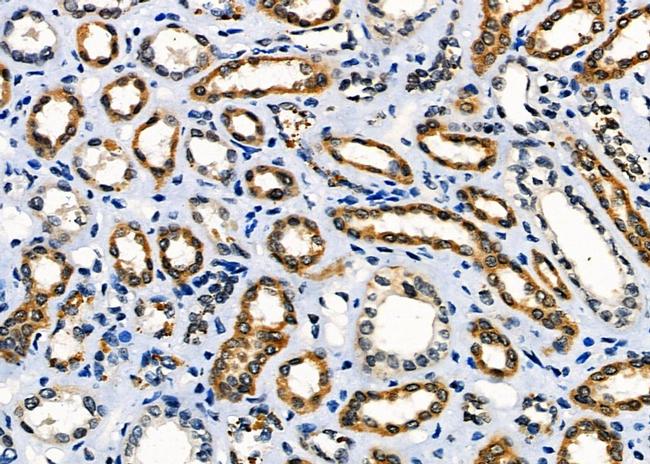 MST2 Antibody in Immunohistochemistry (Paraffin) (IHC (P))