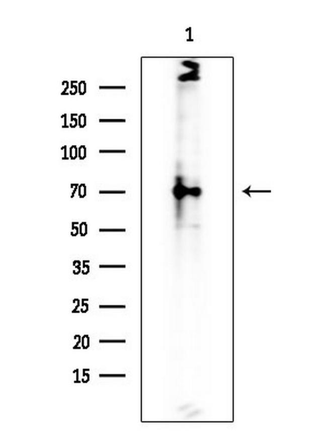 SPAK Antibody in Western Blot (WB)