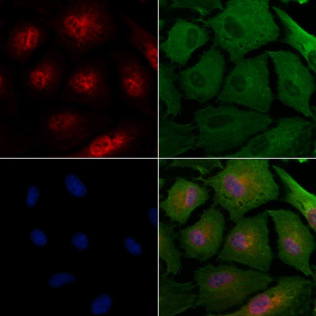 STRA8 Antibody in Immunocytochemistry (ICC/IF)