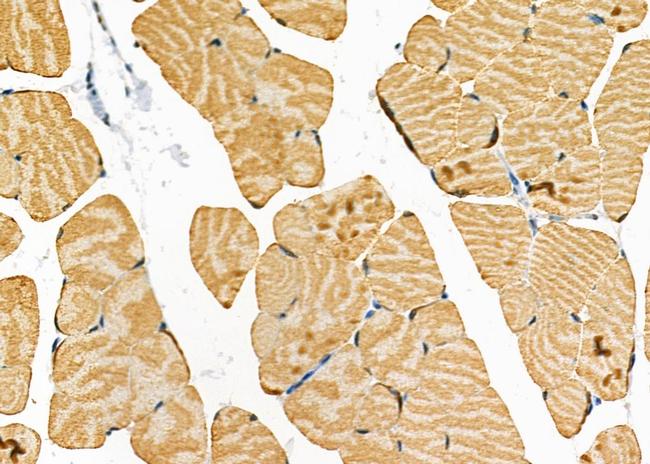 STRN4 Antibody in Immunohistochemistry (Paraffin) (IHC (P))