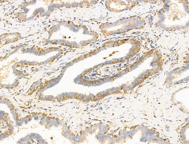 SUCLG1 Antibody in Immunohistochemistry (Paraffin) (IHC (P))