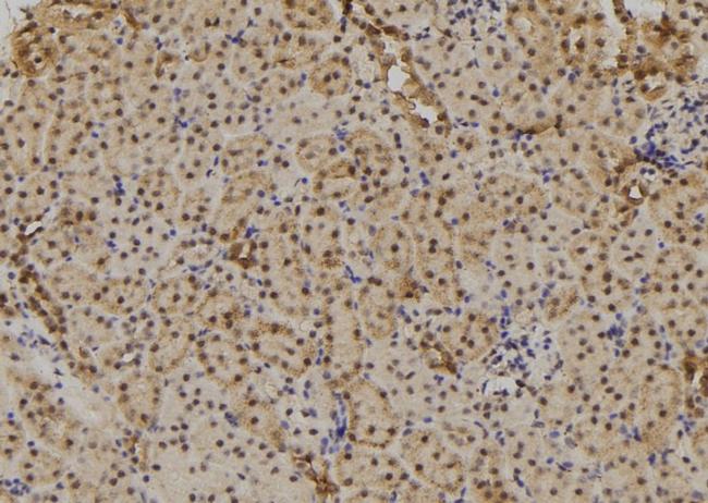 TAB1 Antibody in Immunohistochemistry (Paraffin) (IHC (P))