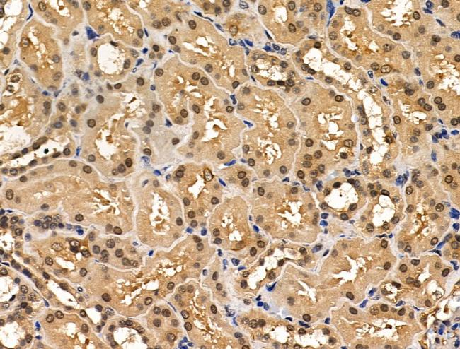 TBLR1 Antibody in Immunohistochemistry (Paraffin) (IHC (P))