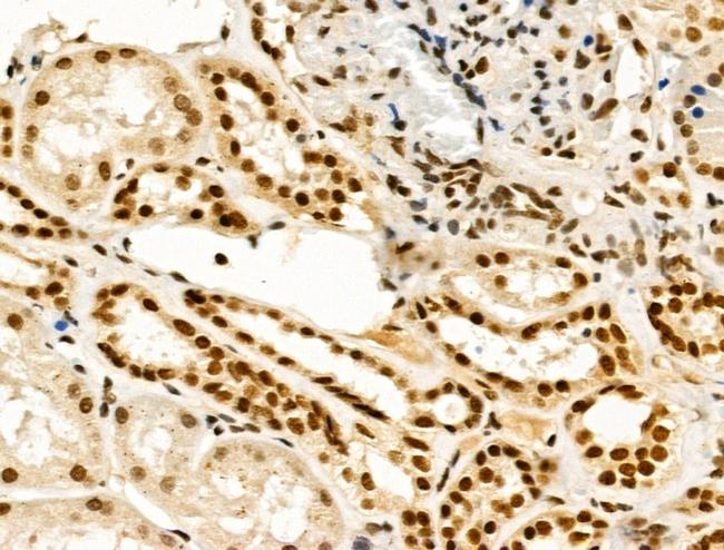 TBP Antibody in Immunohistochemistry (Paraffin) (IHC (P))