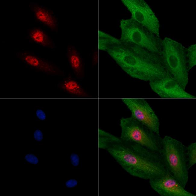 TCF21 Antibody in Immunocytochemistry (ICC/IF)