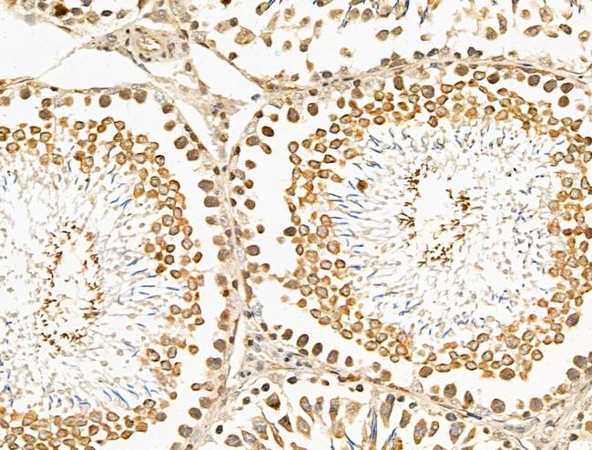 TEAD2 Antibody in Immunohistochemistry (Paraffin) (IHC (P))