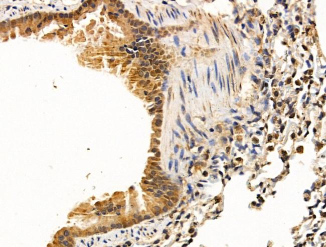 TNMD Antibody in Immunohistochemistry (Paraffin) (IHC (P))