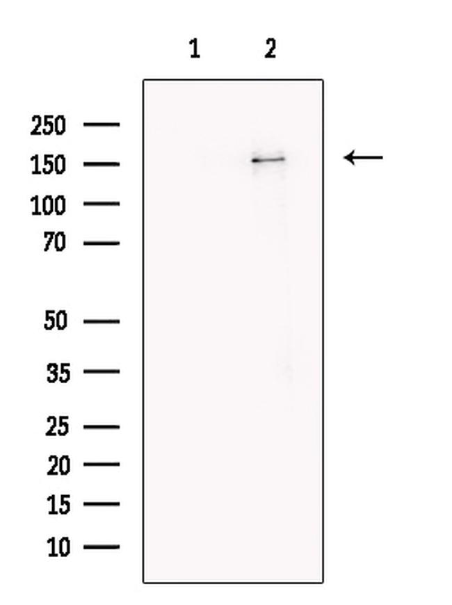 TEX14 Antibody in Western Blot (WB)