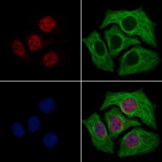 TFAP4 Antibody in Immunocytochemistry (ICC/IF)