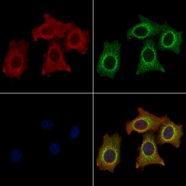 TFPI Antibody in Immunocytochemistry (ICC/IF)