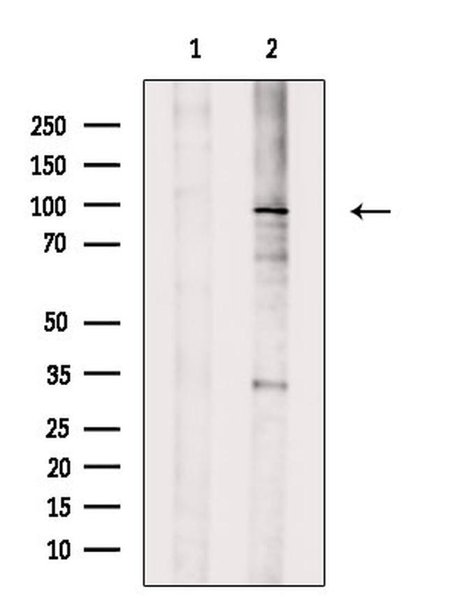 TGFBR3 Antibody in Western Blot (WB)