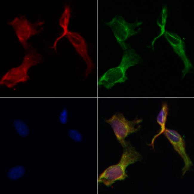 PAR1 Antibody in Immunocytochemistry (ICC/IF)