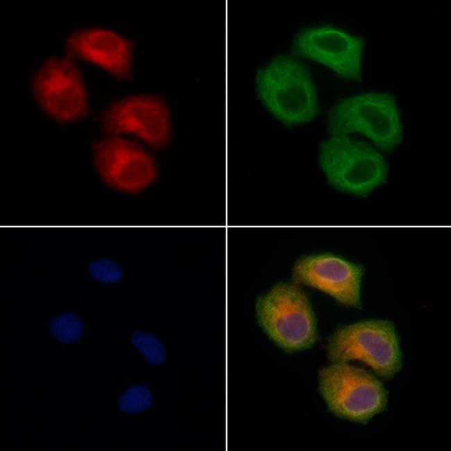 TOM1L2 Antibody in Immunocytochemistry (ICC/IF)