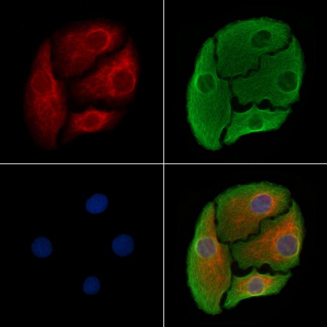 5T4 Antibody in Immunocytochemistry (ICC/IF)