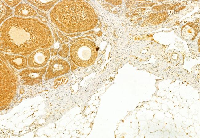 Transferrin Receptor Antibody in Immunohistochemistry (Paraffin) (IHC (P))