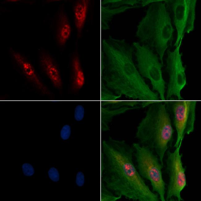 TNPO1 Antibody in Immunocytochemistry (ICC/IF)