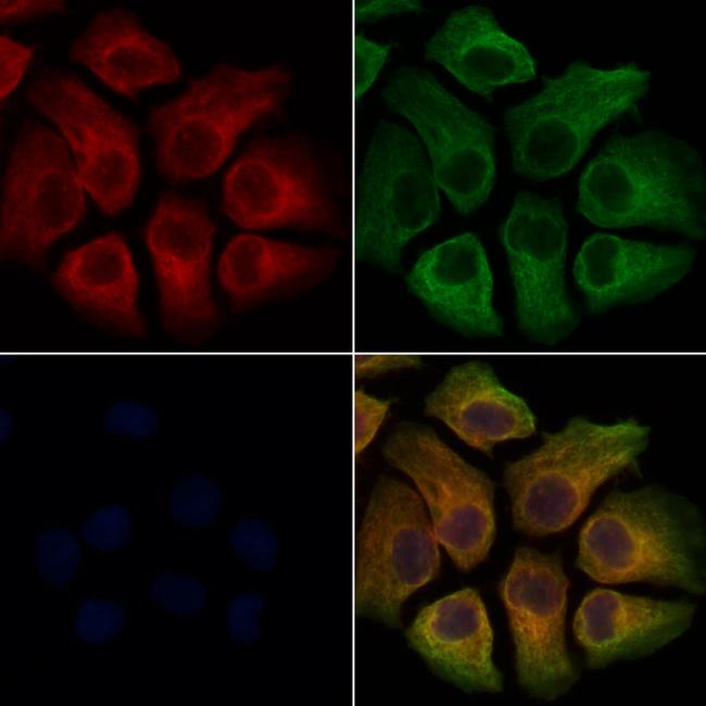 TREM2 Antibody in Immunocytochemistry (ICC/IF)