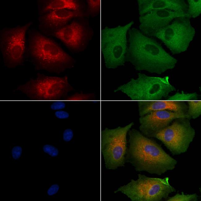 BERP Antibody in Immunocytochemistry (ICC/IF)