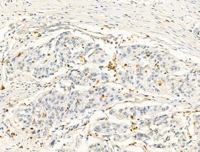 ZFP36 Antibody in Immunohistochemistry (Paraffin) (IHC (P))