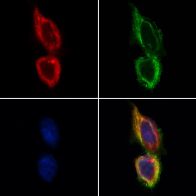 TSC1 Antibody in Immunocytochemistry (ICC/IF)