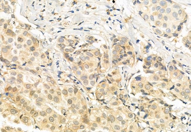 TSG101 Antibody in Immunohistochemistry (Paraffin) (IHC (P))