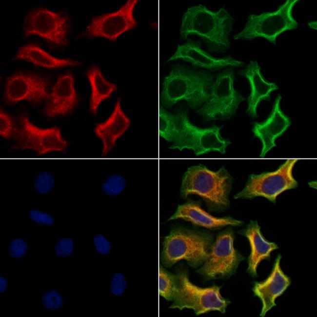 TSH Receptor Antibody in Immunocytochemistry (ICC/IF)