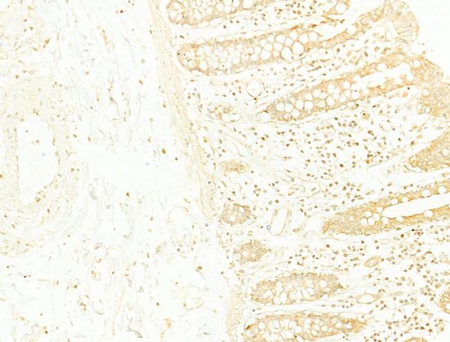 TWIST1 Antibody in Immunohistochemistry (Paraffin) (IHC (P))