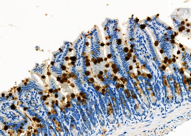 TrxR1 Antibody in Immunohistochemistry (Paraffin) (IHC (P))