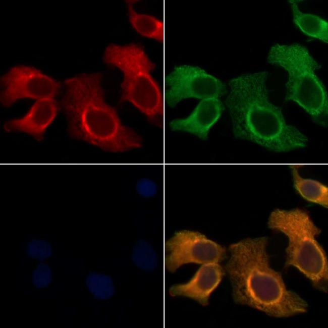 UBE2L6 Antibody in Immunocytochemistry (ICC/IF)