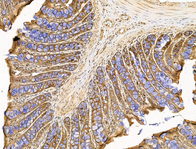 UGT1A6 Antibody in Immunohistochemistry (Paraffin) (IHC (P))