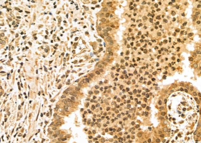 UHRF1 Antibody in Immunohistochemistry (Paraffin) (IHC (P))