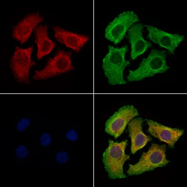 UNC5B Antibody in Immunocytochemistry (ICC/IF)